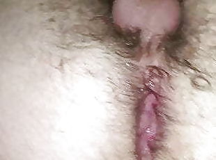 My first anal prolapse