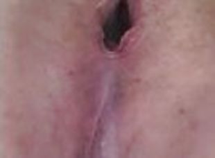 Anal Gape maintenance