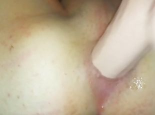 Anal close up