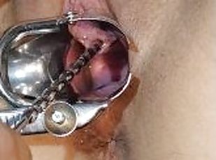 This time we finally used a speculum so you can see my urethra even...